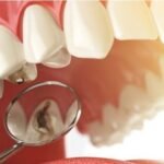 Common Dental Problems and Their Solutions
